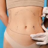 The "Liposuction in Riyadh" user's logo