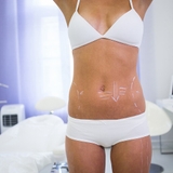 The "Laser liposuction in Riyadh" user's logo
