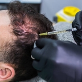 The "PRP Hair Treatment in Riyadh" user's logo