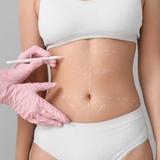 The "laser liposuction in Riyadh" user's logo
