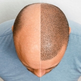 The "Hair transplant in Riyadh" user's logo