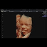 The "Ultrasound scan" user's logo