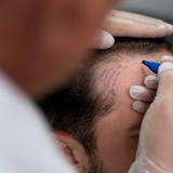 The "PRP Hair Treatment in Riyadh" user's logo